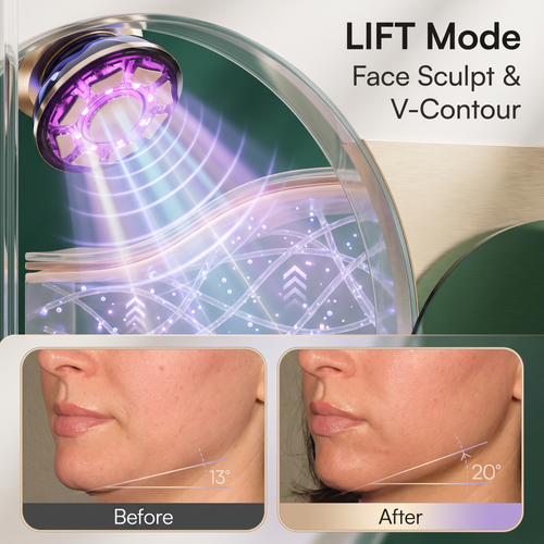 FLARE Microcurrent Facial Device