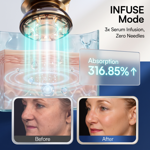 FLARE Microcurrent Facial Device